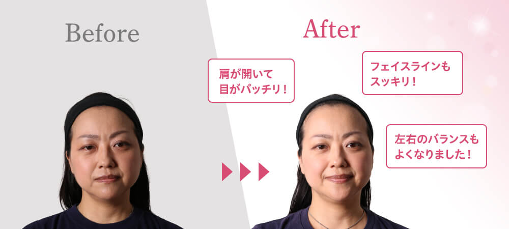 施術する前後を比較