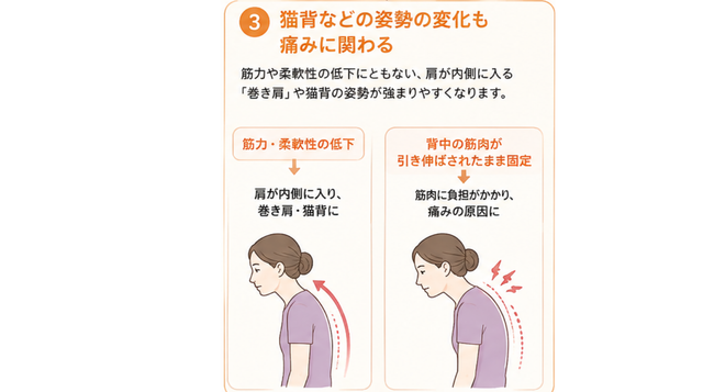 猫背などの姿勢の変化も痛みに関わる